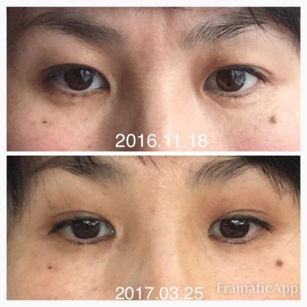 Face-Yoga-Practice-Results-3