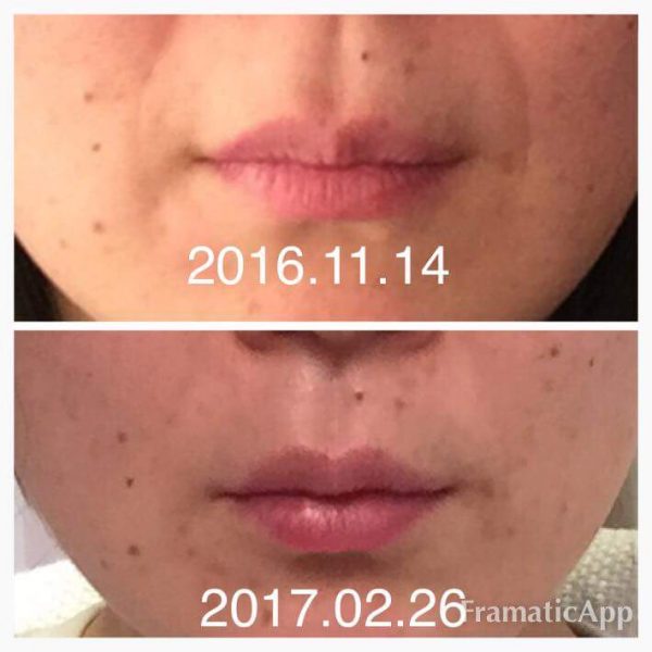 Face-Yoga-Practice-Results-4