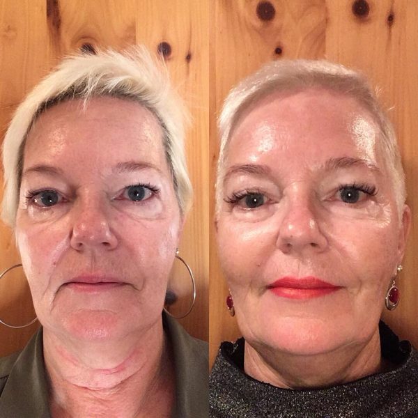 Face-Yoga-Practice-Results-7